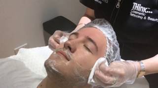 Hydrodermabrasion Facial  THink Aesthetics [upl. by Alyek]