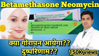 Betnovate N cream  Betamethasone Neomycin cream  betnovate n skin cream [upl. by Ayim278]