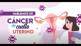 Braquiterapia novedosa técnica para combatir el cáncer de útero [upl. by Oulman344]