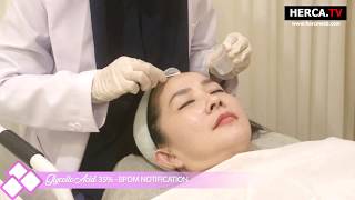 Mesopeel Glycolic Acid  HERCA [upl. by Leund]