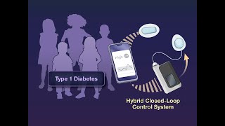 Hybrid ClosedLoop Control in Young Children with Type 1 Diabetes  NEJM [upl. by Kacie]