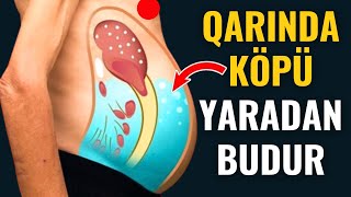 Qarındakı Köp Probleminin Çarəsi  Xalq Təbabətində Müalicəsi [upl. by Notsyrb]