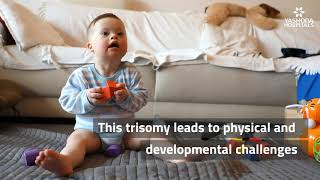 Down Syndrome Explained in a Minute  Child with Down Syndrome [upl. by Floridia22]