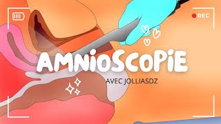 Amnioscopie [upl. by Waylan]