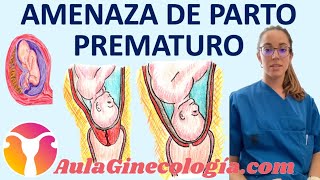 AMENAZA de PARTO PRETÉRMINO DIAGNÓSTICO y TRATAMIENTO del PARTO PREMATURO Ginecología y Obstetricia [upl. by Lubin]