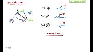 ECG  Normal Axis Right amp Left Axis Deviation  ECG Simplified Episode 3  Dr Shankar Dey [upl. by Oninrutas434]