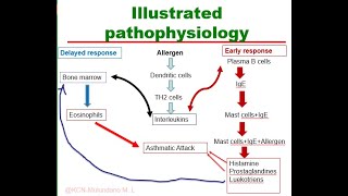 Pathophysiology of Asthma Illustrated [upl. by Cordle527]