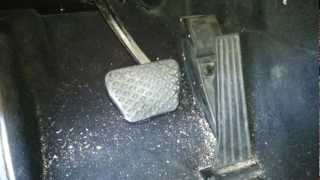 How to remove gas pedal off Bmw E46 330 325 E38 740 E39 M5 540i 530i 525i [upl. by Aicele741]