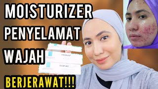 REVIEW LA ROCHE POSAY CICAPLAST BAUME B5  6 bulan pakai hasilnya [upl. by Charline]