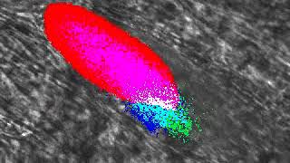 Thrombus Formation in Real Time [upl. by Kir]