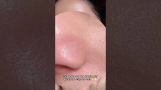 Remove blackheads amp whiteheads at home🫢👃🏻💯shorts [upl. by Mosier852]