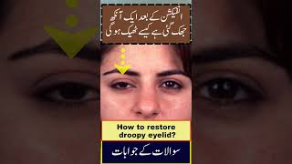 How to fix droopy eyelids without surgery  Jhuki Ankh ka ilaj [upl. by Eivlys]