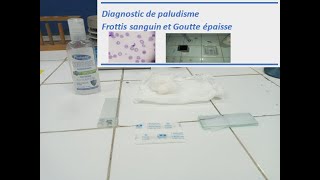 Diagnostic de paludisme  Frottis sanguin et Goutte épaisse [upl. by Yeffej]