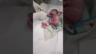 nicu me preterm baby newborn baby nicu pretermbaby girl nursing care [upl. by Ayhtin]