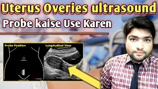 Mastering Uterus and Ovaries Ultrasound Probe Orientation A StepbyStep Guide [upl. by Anirdnaxela]