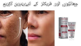 Best cream for pigmentations and freckls  Bioxsine whitening face cream [upl. by Naired199]