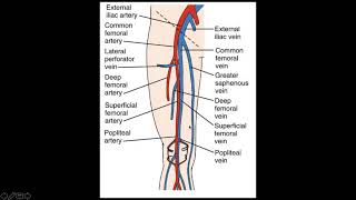 Lower Extremity Deep Venous Thrombosis DVT [upl. by Ynnep]