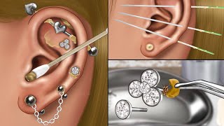 ASMR Piercing Cleaning Animation👂 Blackhead Removing Pus from Piercing Ear Infection Treatment [upl. by Htaek]