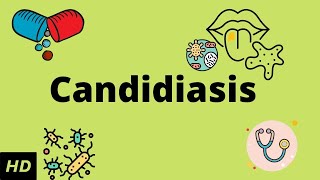 CANDIDIASIS Causes Signs and Symptoms Diagnosis and Treatment [upl. by Newhall]