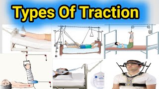 Types Of Traction  Traction Types  Orthopaedic Traction  skin and skeleton [upl. by Noerb]