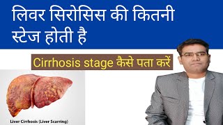 What are the stages of cirrhosis of the liver How to diagnose Cirrhosis Stage 1 2 and 3 [upl. by Kamp18]