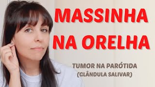 Massinha na orelha  tumor na parótida [upl. by Ilyak]