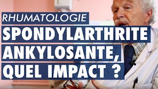 Spondylarthrite ankylosante quel impact pour les patients [upl. by Saddler]