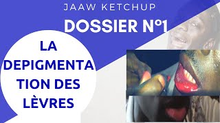 Jaaw ketchup  dossier n1 la dépigmentation des lèvres [upl. by Eleda]