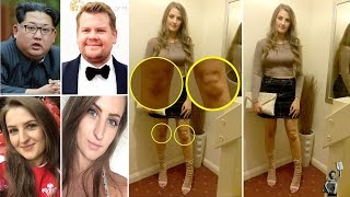 Woman spots faces of James Corden and Kim Jongun in her KNEES [upl. by Yniffit]