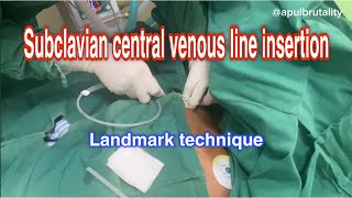 Subclavian central venous line  CVC insertion  vena dalam subklavia [upl. by Atnicaj]