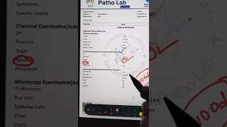 Urine Test In Hindi  Urine Test Report  UrineTest Analysis  Urine Test Report Kaise Dekhehba1c [upl. by Acima]