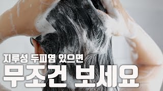 지루성 두피염 그냥 사라집니다 제발 돈 낭비 하지 마세요 [upl. by Notsle]