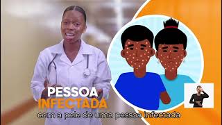 O que é a mpox [upl. by Serrell]