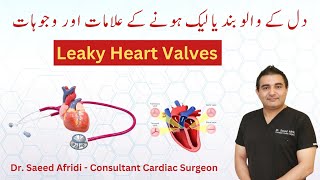 Leaky Heart Valves  Causes and Symptoms  HindiUrdu [upl. by Latea548]