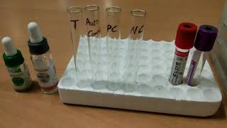 Indirect Coombs test by Tube method [upl. by Duffie]