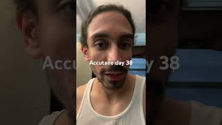 Accutane day 38 acne acnetreatment accutane [upl. by Irot825]