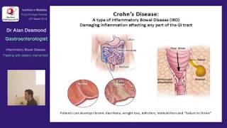 Treating Inflammatory Bowel Disease with dietary intervention by Dr Alan Desmond Gastroenterologist [upl. by Renferd723]