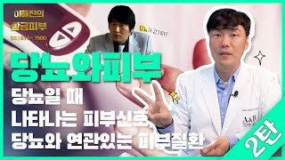 당뇨의 무서운 점은 피부로도 합병증이 나타날수 있다는 것입니다  연세에이앤비 피부과 이해진원장 [upl. by Zetrok]