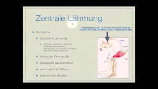 Basiskurs Neurologie Lähmungen Teil 214 [upl. by Gmur434]