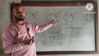 Class10 Science Myopia and Hypermetropia with their Correction [upl. by Ande]