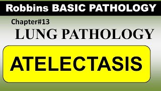 Chp13 Robbins Patho  Lung Pathology  ATELECTASIS [upl. by Awjan563]