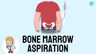 Bone marrow Aspiration and Biopsy Procedure explained [upl. by Samantha276]