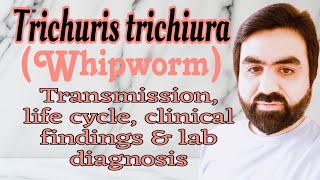 Lec26  Trichuris trichiura  Whipworm  Transmission  life cycle  clinical findings  UrduHindi [upl. by Nylqcaj]