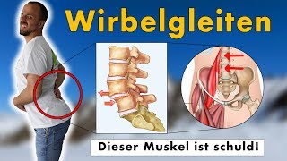 Gleitwirbel Wirbelgleiten wegtrainieren  GENAUE Ursache und 1 Übungen die NACHHALTIG hilft [upl. by Maxentia645]