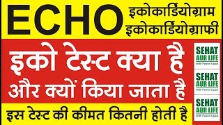 इको टेस्ट क्या है और क्यों किया जाता है इस टेस्ट की कीमत कितनी होती है ECHO Echocardiogram [upl. by Sapers]