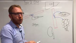 Type 2 Diabetes Pathophysiology [upl. by Enomor]