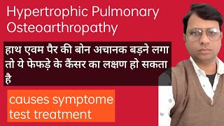 Hypertrophic pulmonary osteoarthropathy causes symptoms diagnosis Treatment pathology [upl. by Suoicerpal496]