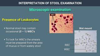 Interpretation of Stool Examination [upl. by Orbadiah]