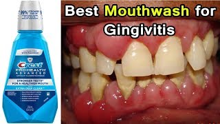 Top 3 Best Mouthwashes for Gingivitis Disease  Periodontal Disease [upl. by Mosby117]