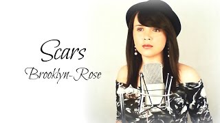 Scars  James Bay By BrooklynRose [upl. by Aima]